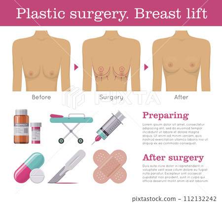 Breast lift plastic surgery 112132242