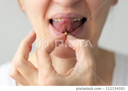 Woman with piercing on the tongue with plaque on the surface of jewellery. Oral care concept. Woman with piercing on the tongue with plaque on the surface of jewellery. Oral care concept. 112134381