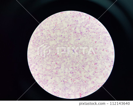 red cell Gram negative bacilli in hemoculture. red cell Gram negative bacilli in hemoculture. 112143640