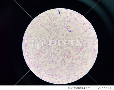 red cell Gram negative bacilli in hemoculture. 112143644