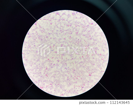 red cell Gram negative bacilli in hemoculture. red cell Gram negative bacilli in hemoculture. 112143645