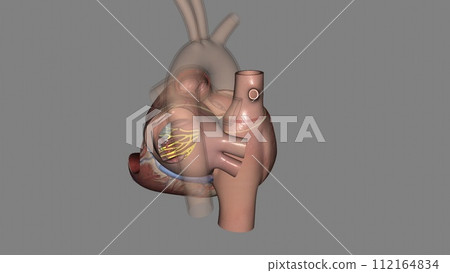 Heart posterior fascicle Heart posterior fascicle 112164834
