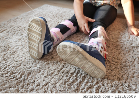 Child with orthopedic shoes sitting on carpet  112166509