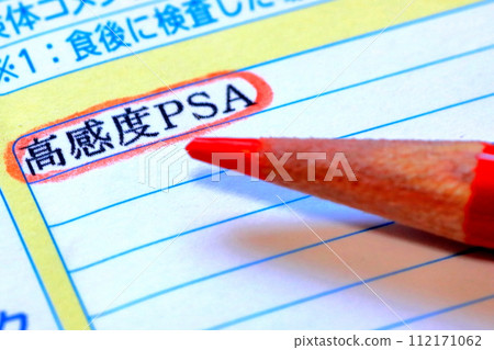Blood test report (high sensitivity PSA/prostate disease) 112171062