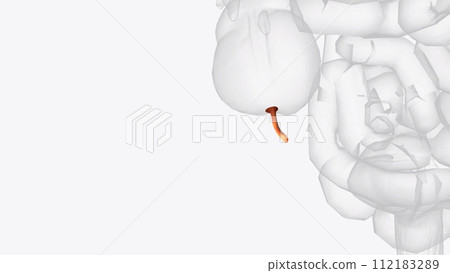 The appendix is a small pouch attached to the end of the large intestine 112183289