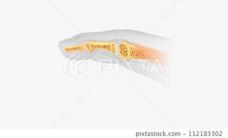 Nail section of bone Nail section of bone 112183302