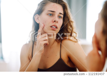 Close-up of a young woman looking at pimples in the mirror. Red spots, rash, acne. Skin treatment. Close-up of a young woman looking at pimples in the mirror. Red spots, rash, acne. Skin treatment. 112191437