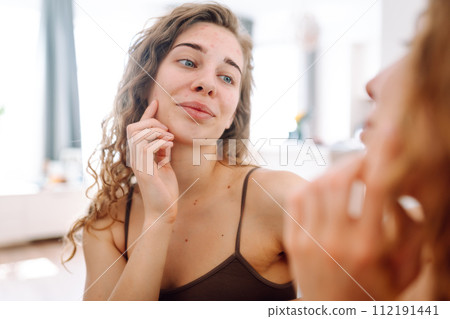Close-up of a young woman looking at pimples in the mirror. Red spots, rash, acne. Skin treatment. 112191441