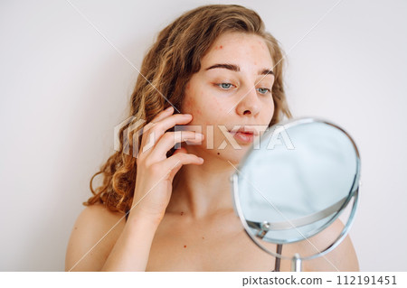Close-up of a cute woman with problem skin looking in the mirror. Dermatology concept, allergy. Close-up of a cute woman with problem skin looking in the mirror. Dermatology concept, allergy. 112191451