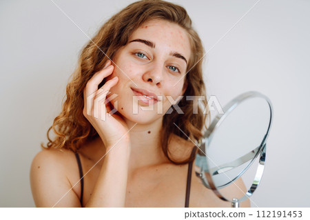 Close-up of a cute woman with problem skin looking in the mirror. Dermatology concept, allergy. Close-up of a cute woman with problem skin looking in the mirror. Dermatology concept, allergy. 112191453