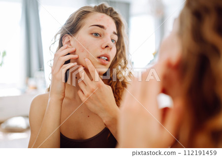 Close-up of a young woman looking at pimples in the mirror. Red spots, rash, acne. Skin treatment. 112191459