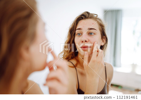 Close-up of a young woman looking at pimples in the mirror. Red spots, rash, acne. Skin treatment. 112191461