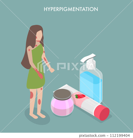 3D Isometric Flat Vector Illustration of Hyperpigmentation 112199404