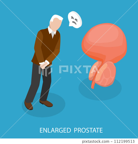 3D Isometric Flat Vector Illustration of Enlarged Prostate 112199513
