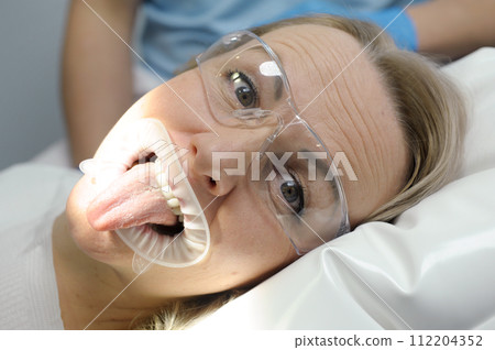 adult woman shows tongue in dental chair in transparent glasses close-up face wrinkles on the forehead surprised look lie on the pillow with optragate mouth expander 112204352