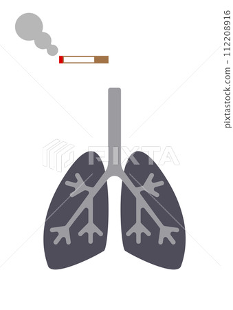 Illustration of a smoker's lungs 112208916