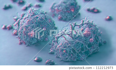 Cancer cells. Growth of a tumor, 3D illustration Cancer cells. Growth of a tumor, 3D illustration 112212973