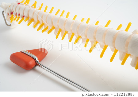 Human spinal nerve and bone with percussion reflex hammer, model for treatment medical in the orthopedic department. 112212993