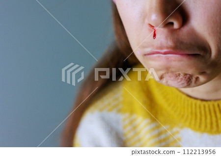 一名婦女的嘴裡有血從她的鼻子流出來(部分被切斷) 一名婦女的嘴裡有血從她的鼻子流出來(部分被切斷) 112213956
