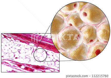 Fat cells, micrograph and 3D illustration 112215760