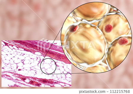 Fat cells, micrograph and 3D illustration Fat cells, micrograph and 3D illustration 112215768