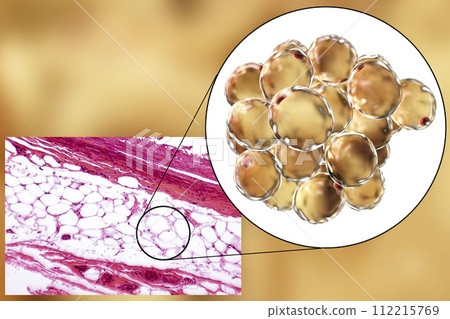 Fat cells, micrograph and 3D illustration 112215769