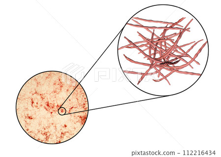Actinomycetes, gram-positive anaerobic bacteria which resemble fungi 112216434
