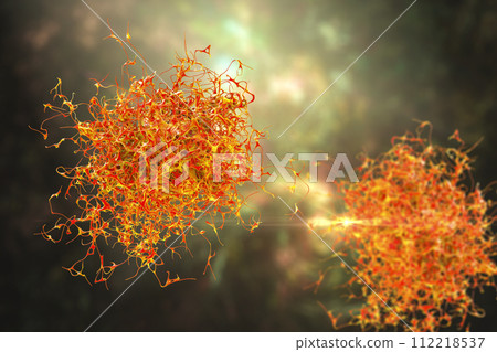 Cancer cell, malignant tumor cell 112218537