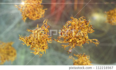 Human parasitic amoeba with pseudopodia 112218567