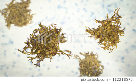 Human parasitic amoeba with pseudopodia Human parasitic amoeba with pseudopodia 112218573