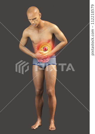 Abdominal pain, conceptual 3D illustration. A patient suffering from stomach pain 112218579