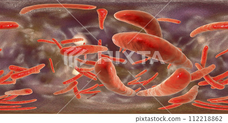 360-degree spherical panorama of bacteria Mycobacterium tuberculosis 112218862