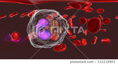 360-degree spherical panorama of blood with eosinophilia 112218901