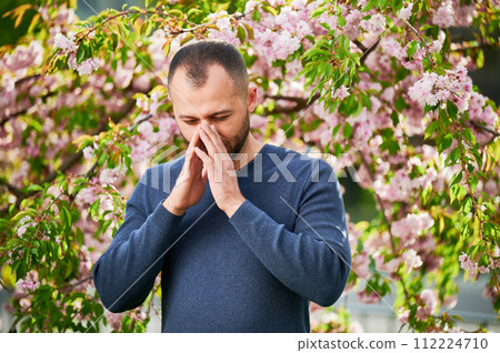 Man allergic suffering from seasonal allergy at spring in blossoming garden at springtime. Bearded young man sneezing and blowing runny nose in front of blooming tree. Spring allergy concept. Man allergic suffering from seasonal allergy at spring in blossoming garden at springtime. Bearded young man sneezing and blowing runny nose in front of blooming tree. Spring allergy concept. 112224710