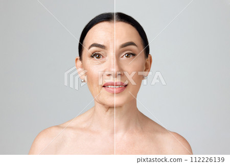 Before-after collage of mature woman showing aging signs and soft, smooth skin after facial care procedures against grey studio background. 112226139