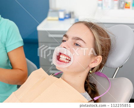 Concept of dental care. Enlarged image of ceramic and metal braces on teeth Concept of dental care. Enlarged image of ceramic and metal braces on teeth 112235851