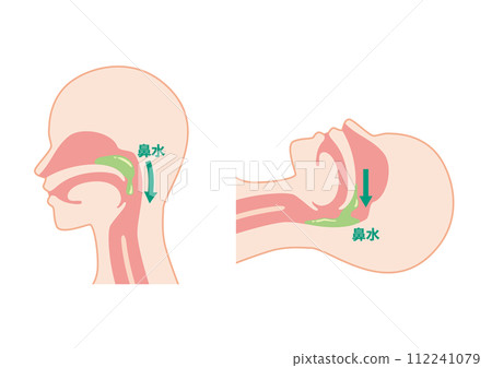 postnasal drip 112241079