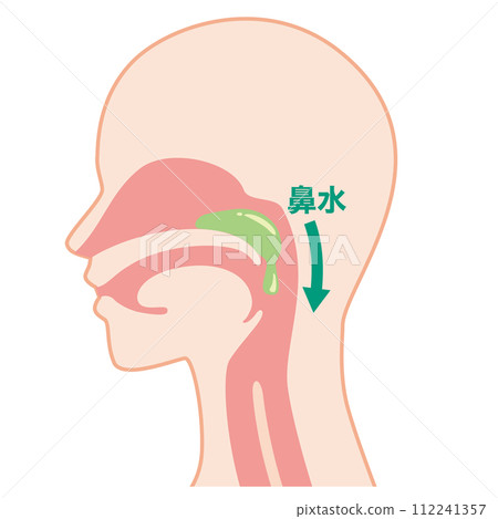 postnasal drip postnasal drip 112241357