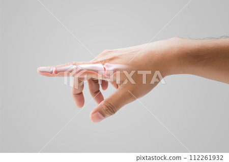 Inflammation of forefinger bone 112261932