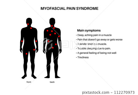 Myofascial trigger points Myofascial trigger points 112270973
