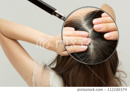 女人的頭皮被放大鏡放大。 112280374
