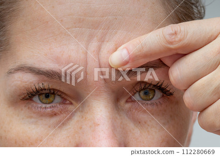 Cropped woman face pointing at wrinkles between eyebrows by finger Cropped woman face pointing at wrinkles between eyebrows by finger 112280669