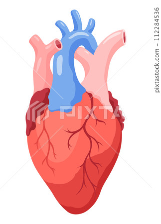Atherosclerosis stage. Anatomy of heart attack. Arteriosclerotic vascular disease or ASVD. Vector illustration on white background 112284536