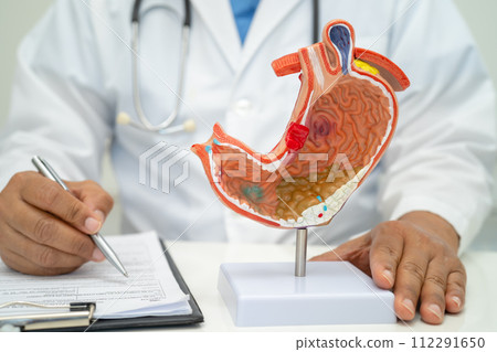 Stomach disease, doctor with anatomy model for study diagnosis and treatment in hospital. Stomach disease, doctor with anatomy model for study diagnosis and treatment in hospital. 112291650