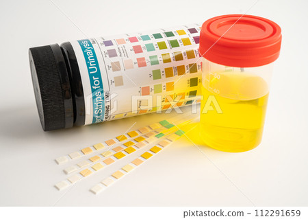 Urinalysis, urine cup with reagent strip pH paper test and comparison chart in laboratory. 112291659