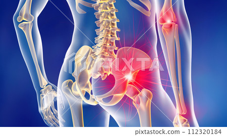 髖關節的視覺表現:體現腰部疼痛與不適的影像<AI產生的材料> 髖關節的視覺表現:體現腰部疼痛與不適的影像<AI產生的材料> 112320184