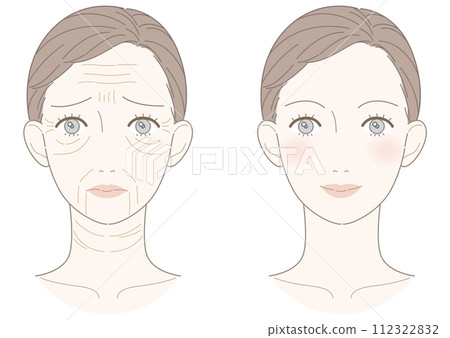 Wrinkle improvement woman illustration 112322832