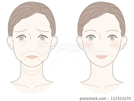 下垂改善女性插畫 下垂改善女性插畫 112323270