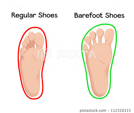 Barefoot shoes impacts on feet vector illustration infographic. Compare comfortable and orthopedic footwear with regular. Barefoot shoes impacts on feet vector illustration infographic. Compare comfortable and orthopedic footwear with regular. 112328315