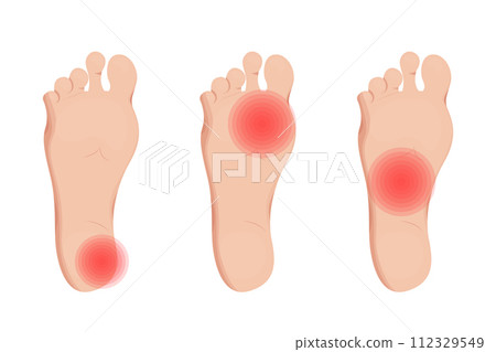 Foot pain, leg injury vector illustration design. Chronic rheumatology and inflammation. 112329549